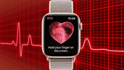 Người dùng Apple Watch phát hiện bị tắc nghẽn tim nhờ tính năng ECG